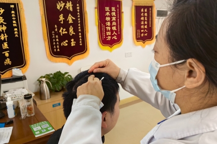 针刺疗法